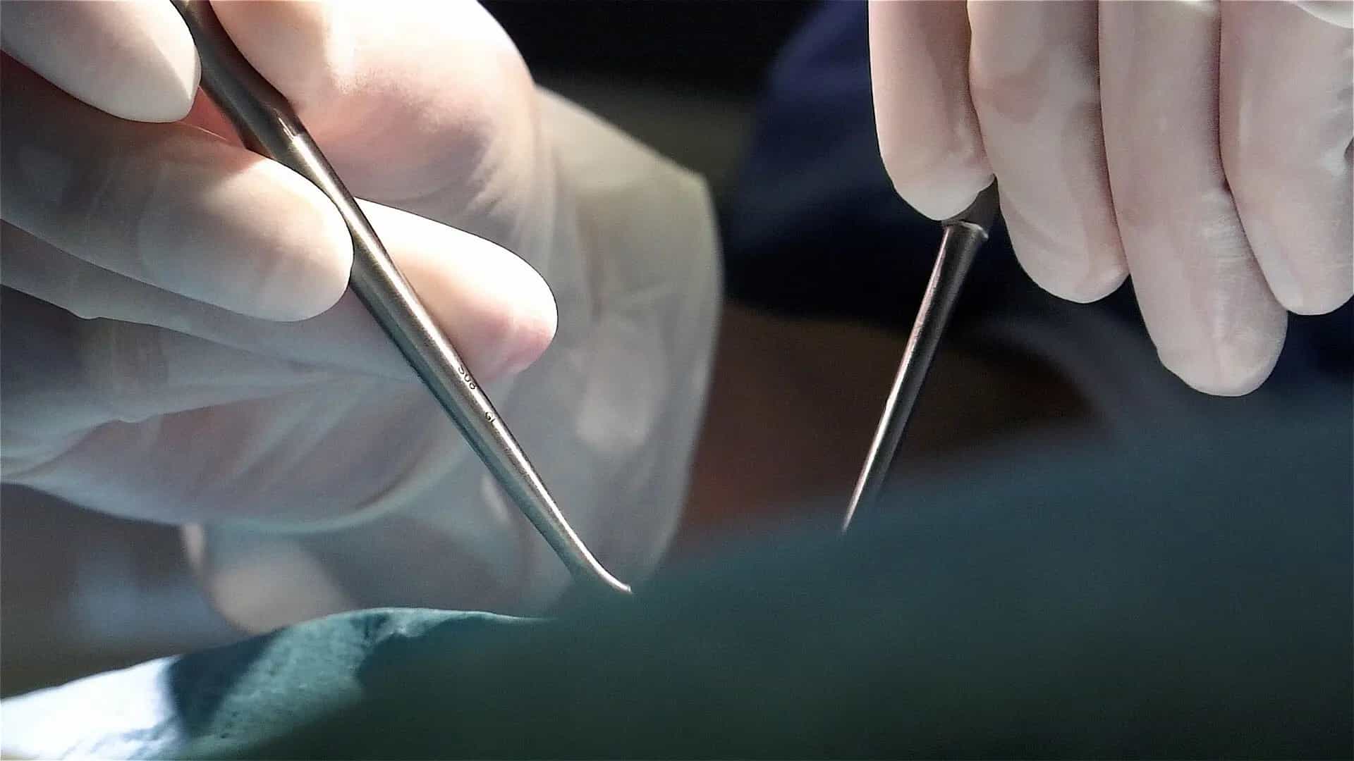 Chirurgie